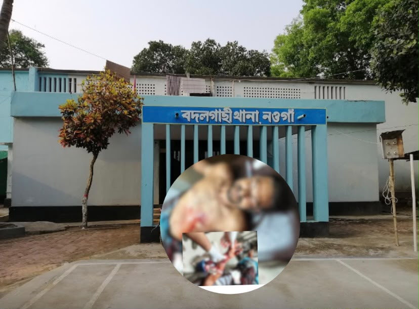 পতিত আওয়ামীলীগের সদস্য কর্তৃক যুবদল নেতার কব্জি কেটে দেওয়ার অভিযোগ, আটক ২